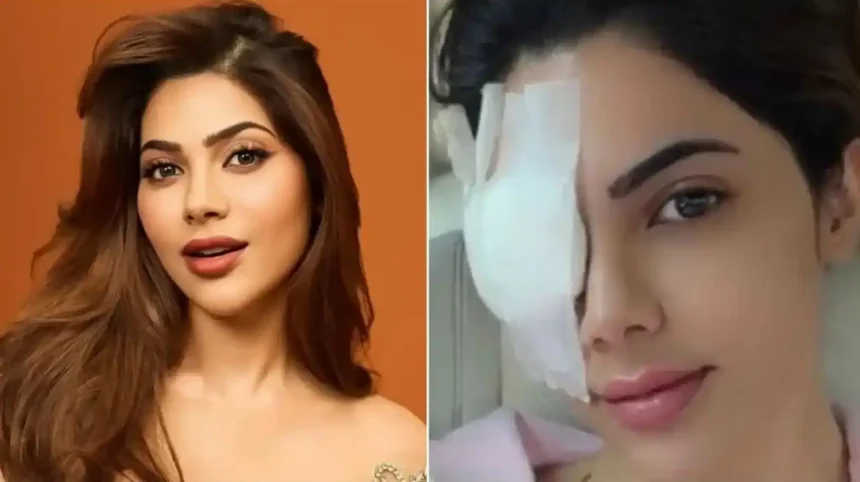 Hunterfly Is Nikki Tamboli Fit for The 50 After Eye Surgery 11zon Hunterfly Is Nikki Tamboli Fit for The 50 After Eye Surgery 11zon
