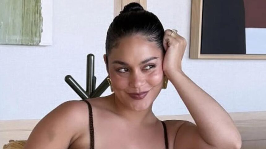 Vanessa Hudgens shows postpartum hair loss and shares her motherhood journey